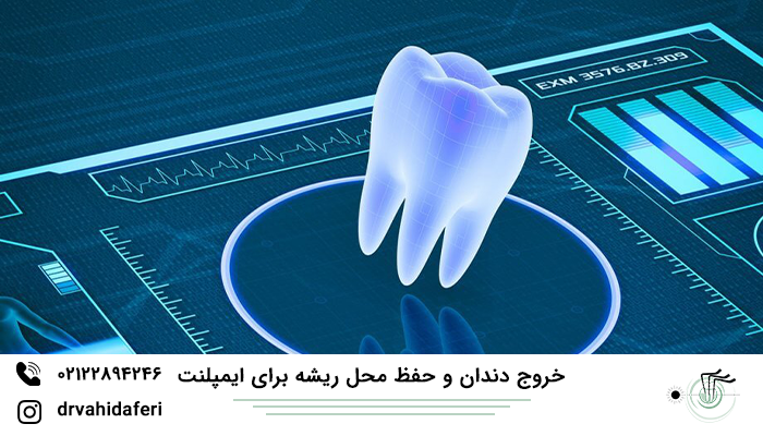 خروج دندان و حفظ محل ریشه برای ایمپلنت