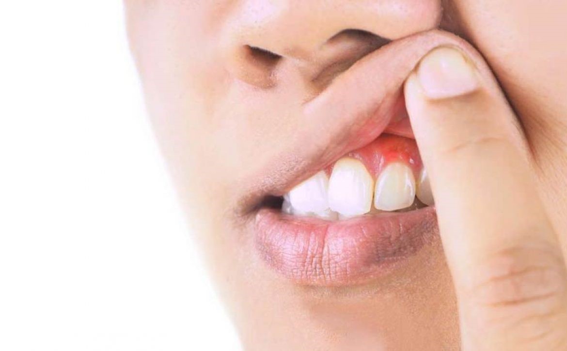 تشخیص بیماری‌های دهان و دندان