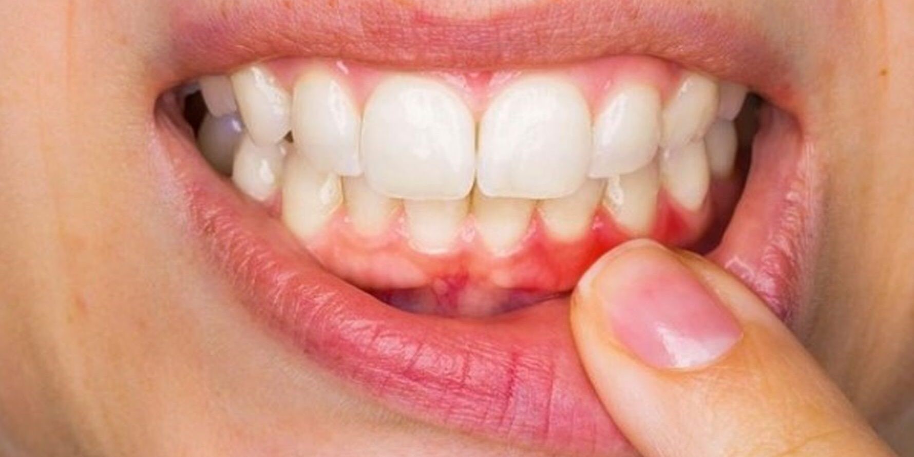 درمان بیماری‌های دهان و دندان