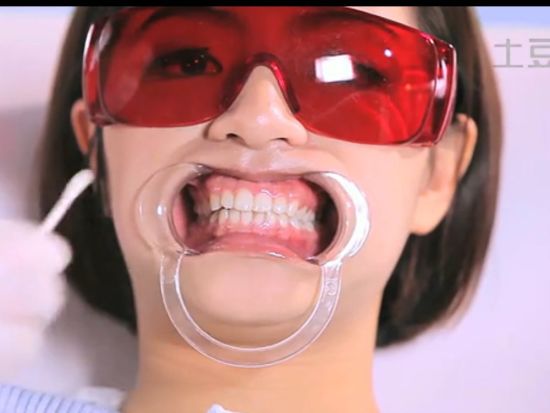 انواع روش‌های زیبایی در دنیای دندانپزشکی