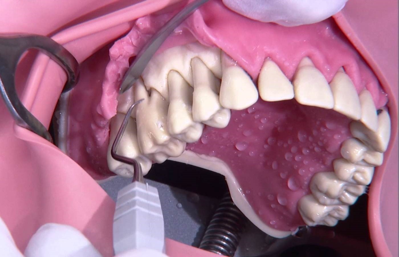 دلایل جراحی دندان