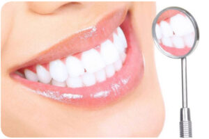 مهمترین عوامل موثر بر هزینه لمینت دندان