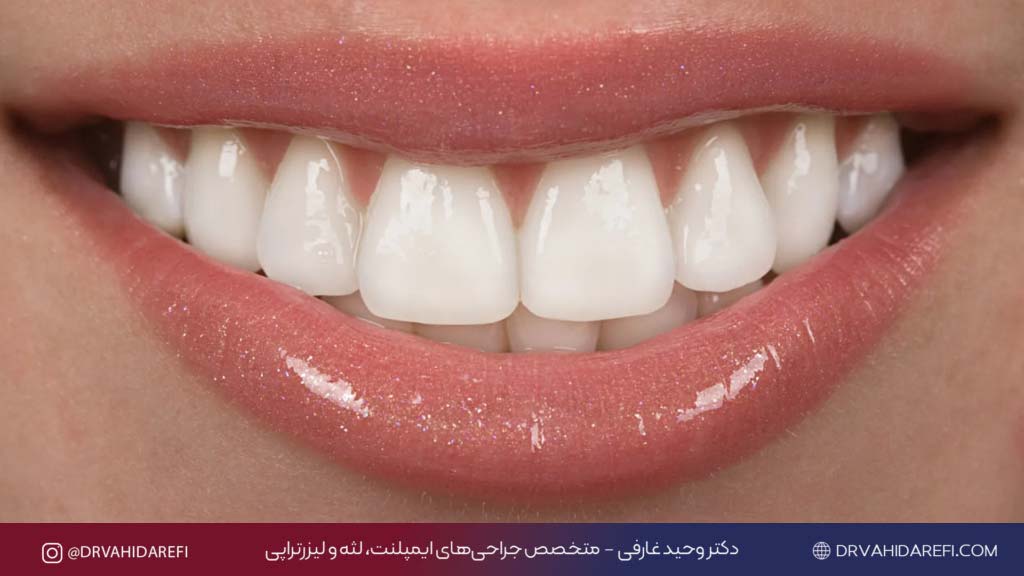 کامپوزیت 2 1