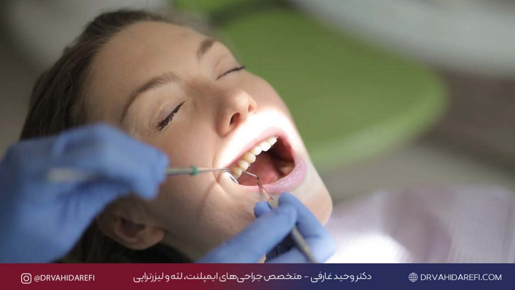 خدمات دندان پزشکی دکتر وحید عارفی 4