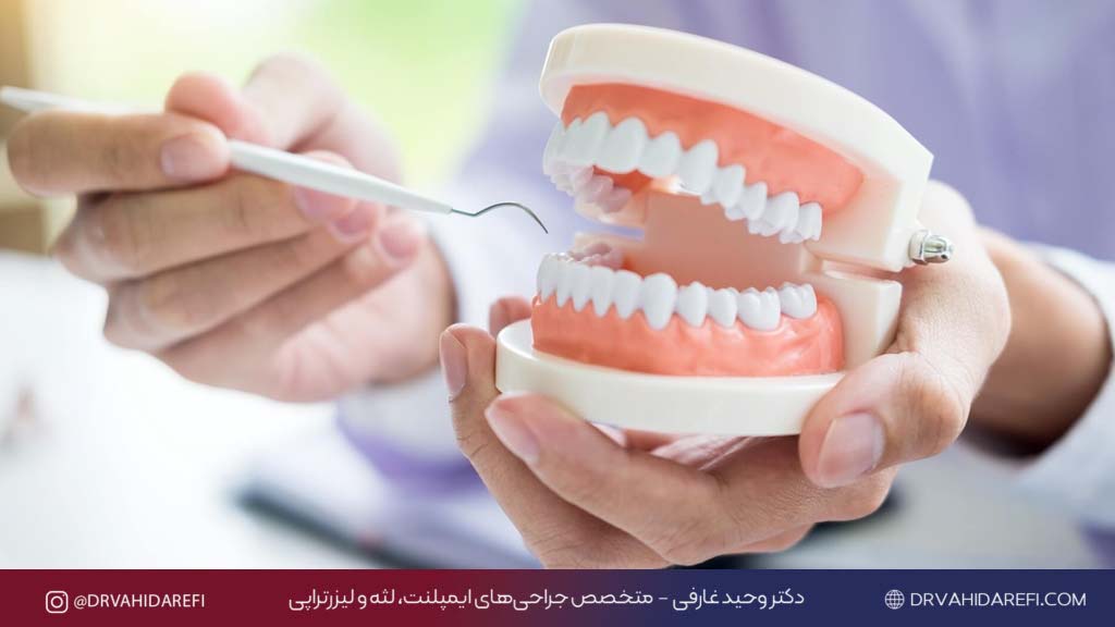 خدمات دندان پزشکی دکتر وحید عارفی 5