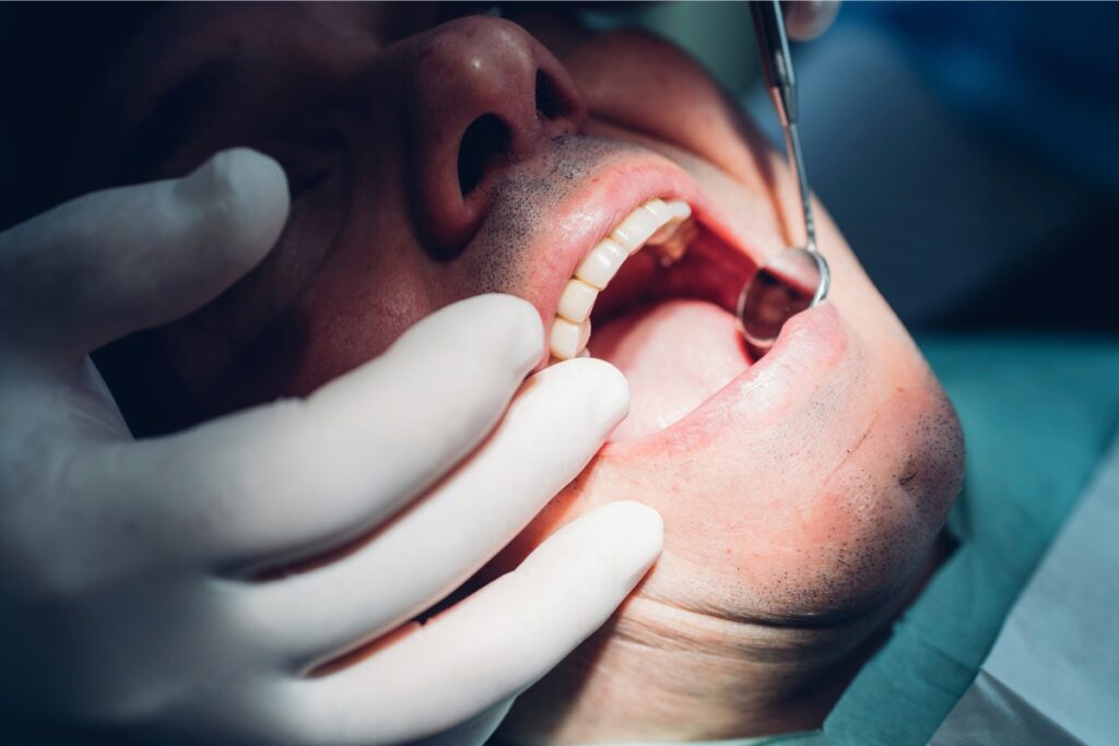dental bone graft healing timeline what to expect from surgery to implants