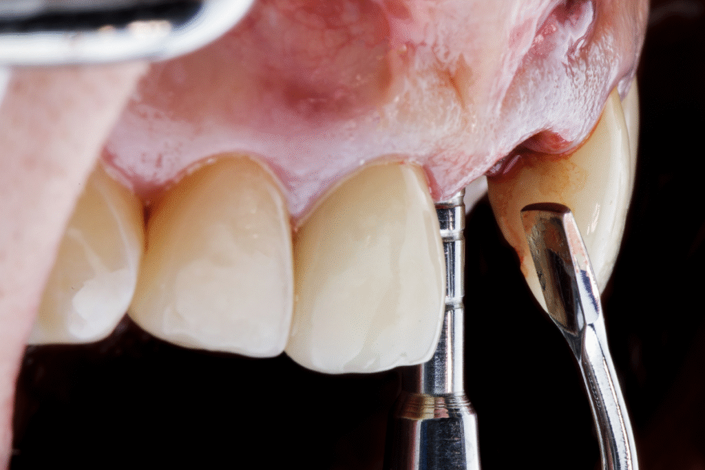 restore your jaw advanced bone grafting solutions in bixby ok